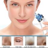 Dead Skin Removal Derma Suction Facial Cleanser - 1 Pack