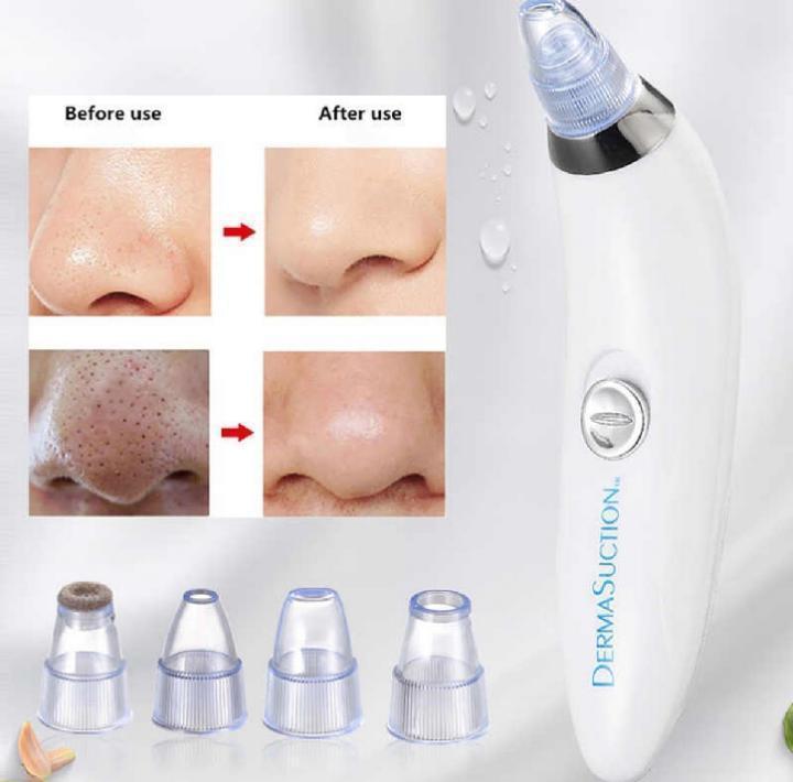 Dead Skin Removal Derma Suction Facial Cleanser - 1 Pack